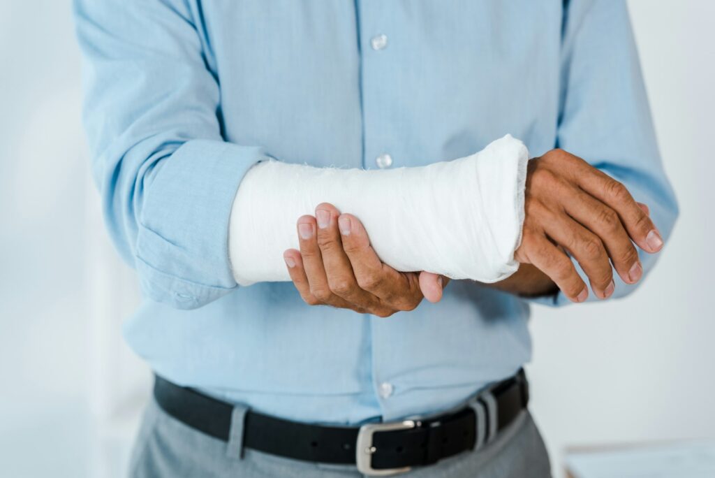 cropped view of injured man touching broken arm wrapped in gypsum bandage